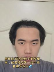 -雍禾植发全国连锁