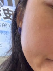 体验后-武汉五洲整形外科医院