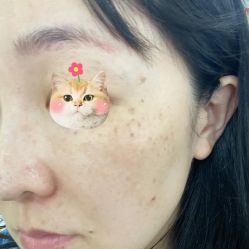 体验前-天津伊美尔医疗整形美容专科医院