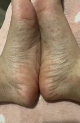 -More摩尔医美の注射线雕光电中心