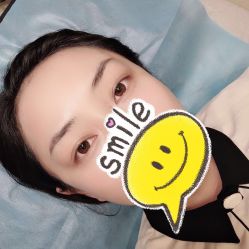 点击看大图 -郡艺医疗美容·微整·眼鼻吸脂