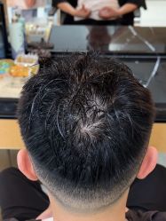 -雍禾植发