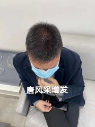 -唐风采假发补发定制