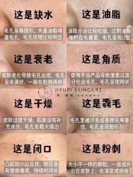 -MLP美丽派·问题肌疗愈中心