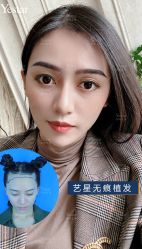 -Yestar艺星医疗美容医院