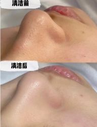 -SKIN79皮肤管理中心