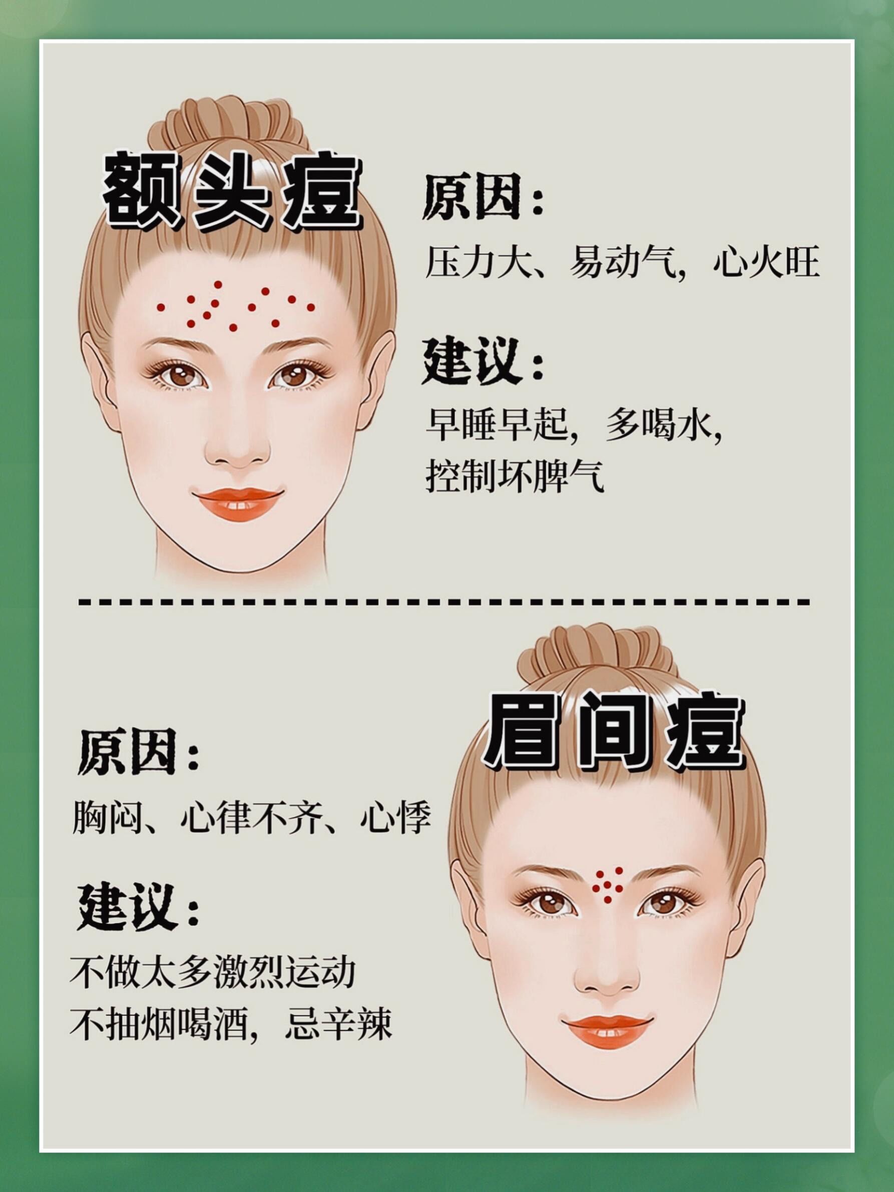 n	
脸上不同部位长痘反馈的身体状态不同
对症调理,痘痘消的