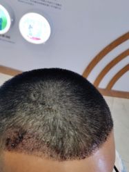 点击看大图 门面-新生植发·植养护一体