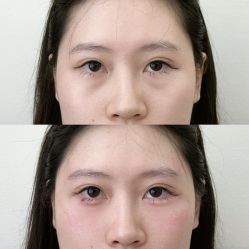 点击看大图 -Yestar艺星医疗美容医院