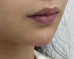 -Yestar重庆艺星医疗美容医院