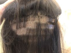 -熙朵美学植发连锁