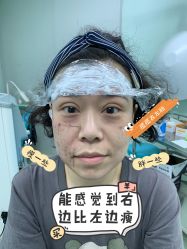 体验前-八大处整形