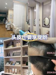 -菩叶脱发白发中心