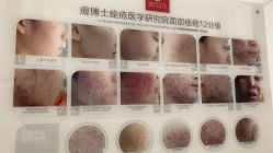 -痘博士烟台·全国连锁祛痘机构