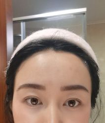 -大麦微针植发丨全国连锁