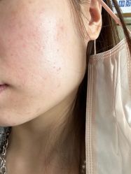 -广州美莱医疗美容医院