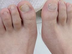 -新甲连锁灰指甲·甲沟炎·鸡眼(黑龙江路店)