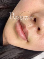 -RC半永久纹眉纹发际线