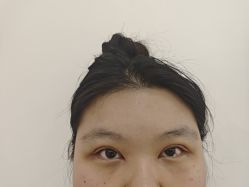 -长沙雅美医疗美容医院