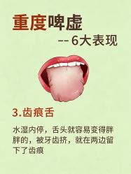 -克丽缇娜