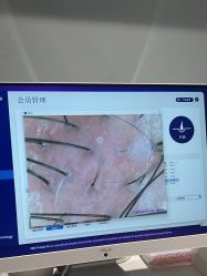 -菩叶脱发白发中心