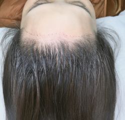 点击看大图 -AYA FACE 微注颜·德式半永久定妆
