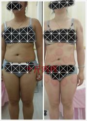 -摩瘦纤体订制减肥