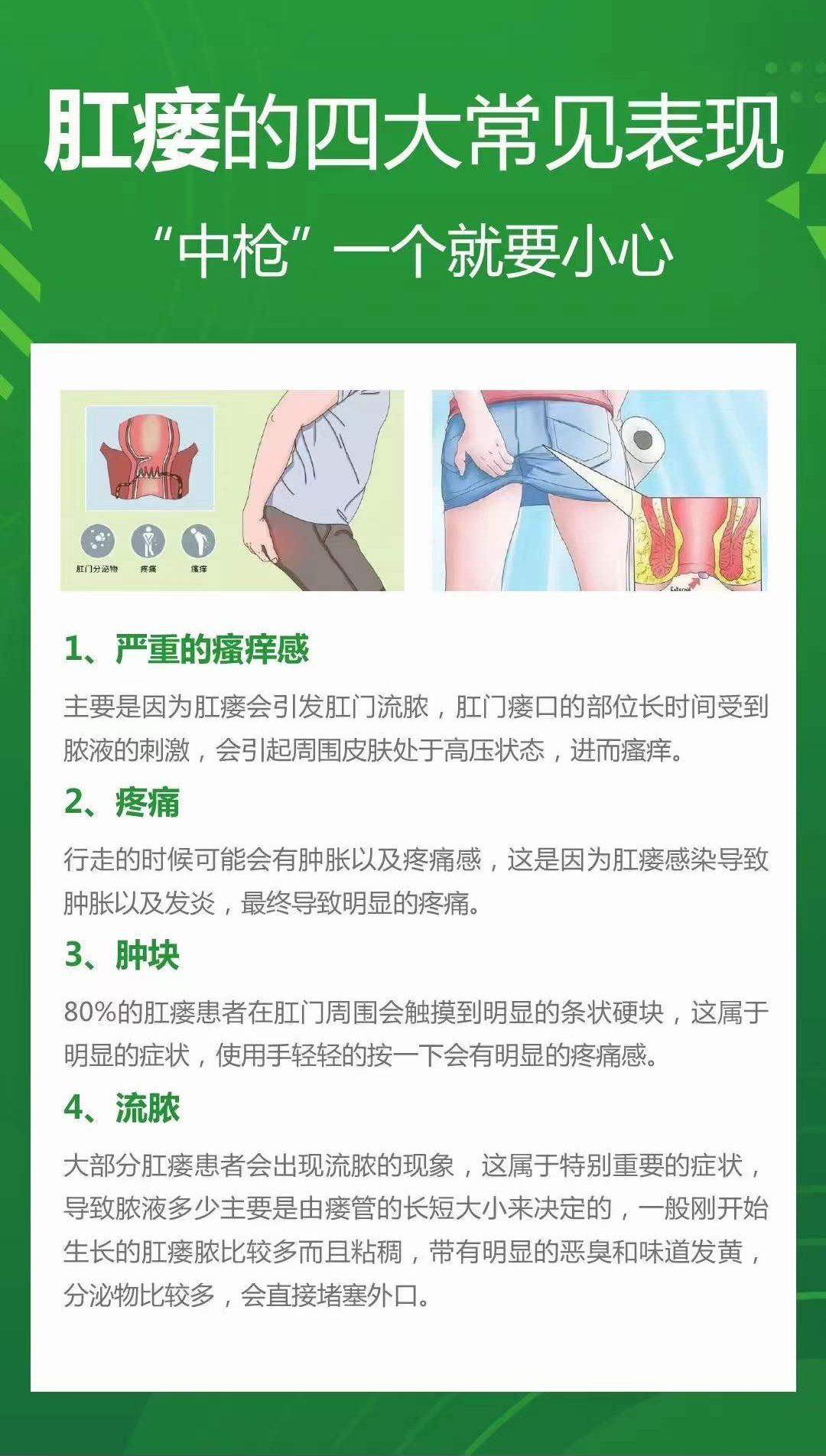 肛瘘四大表现,小心中枪哟