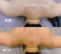 -Lily纤美·科技减脂中心