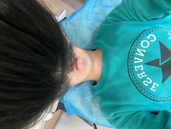 -素美医疗美容·西南眼鼻整形·修复基地