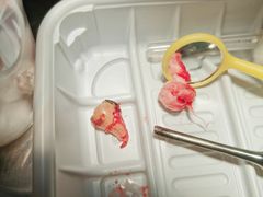 -上海市杨浦区牙病防治所