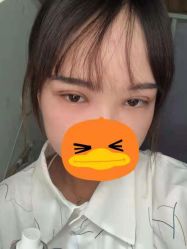 -成都西区医院整形美容