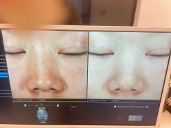 -苑苑vbeauty科技美容SPA