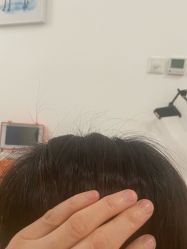-舒欣头疗·俏丝谧语 白发脱发专业护理 