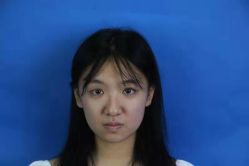 -安徽合肥韩美整形外科医院