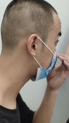 -大麦微针植发全国连锁