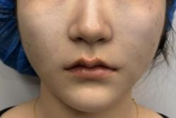 -天津健丽·去眼袋医疗美容机构