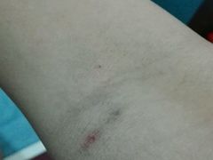 -广州市红十字会医院(总院)