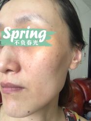 体验后-坤如玛丽·医疗美容中心