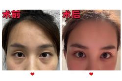 -素美医疗美容·西南眼鼻整形·修复基地