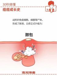 -美肤盾祛痘·问题肌头疗管理中心