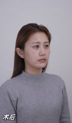 -Yestar重庆艺星医疗美容医院