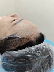 -长沙雅美医疗美容医院