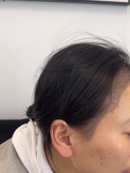 -熙朵美学植发·连锁品牌