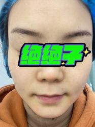 体验前-CMS西美斯·美式医疗美容