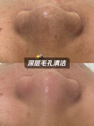 -彼家美创·量肤定制修护管理