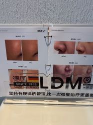 -小梨·OndaPro·专业脱毛连锁机构
