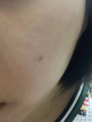 -南宁华美医疗美容医院