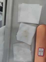 -蕾特恩专业祛痘国际连锁