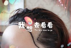 -大麦微针植发全国连锁